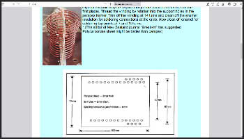 Modifications to the Single Coil Z Match for 1.8 MHz